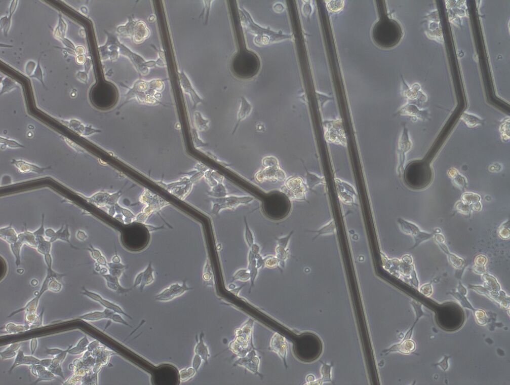 Zellen, die auf einem Computerchip wachsen. Bild: LinkedIn / WARR